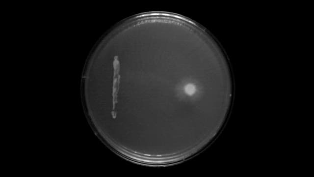 Time-lapse Growth of Bacteria in Petri Dish