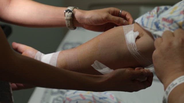 Patient's Arm Receiving Care in Hospital