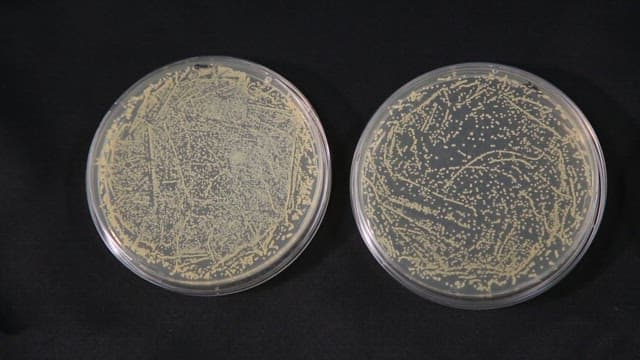 Petri dish for observing Staphylococcus aureus