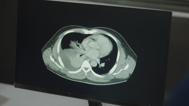 Close-up Images of Medical CT Scan Results