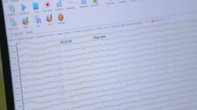 Monitoring brain activity on a computer screen