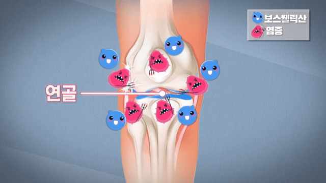 Animated Explanation of Knee Joint Mechanics