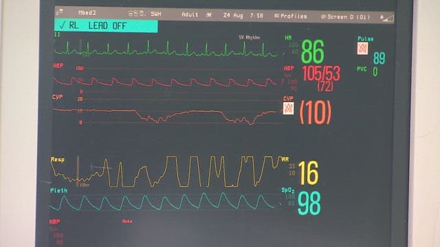 Hospital monitor showing vital signs, heart rate, and blood pressure readings